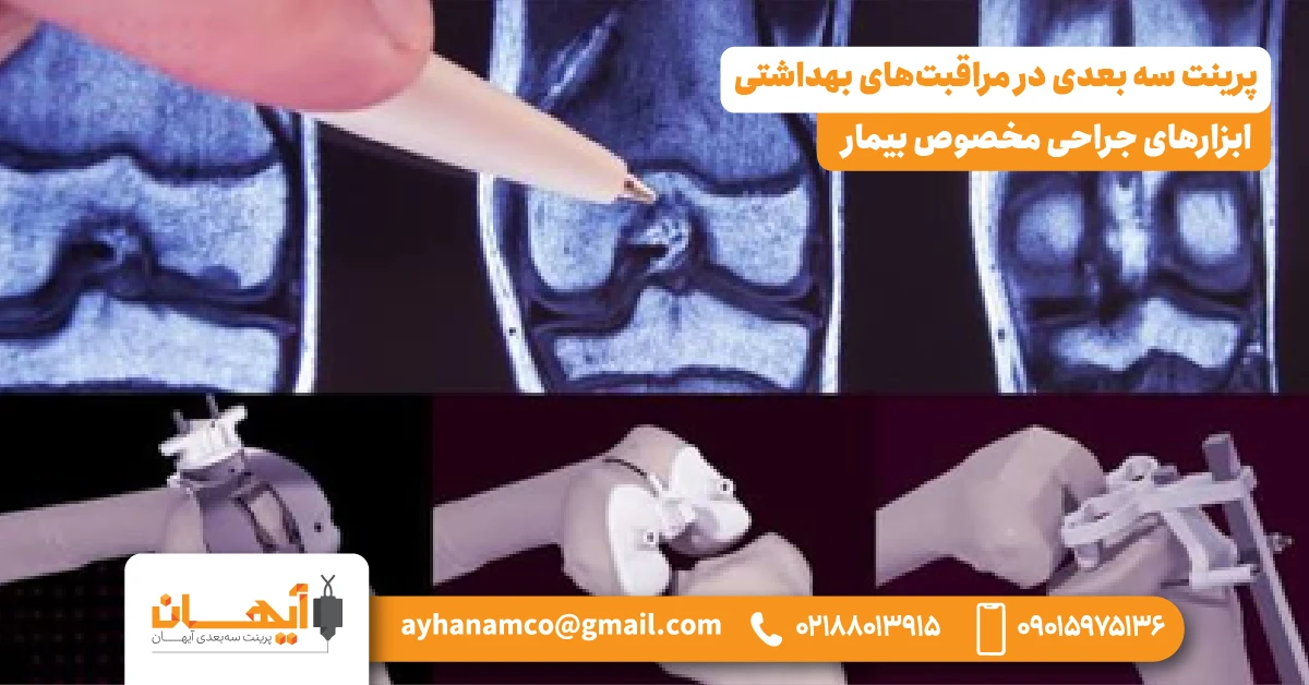 2. ابزارهای جراحی مخصوص بیمار (Patient-Specific Surgical Instruments)